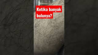 Download Lagu Ketika banyak bulunya?#shorts MP3