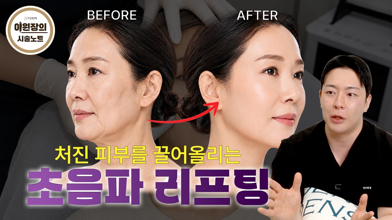  초음파 리프팅, 과연 어떤 시술일까?｜얼굴이 갸름해지는 초음파 리프팅의 모든 것!