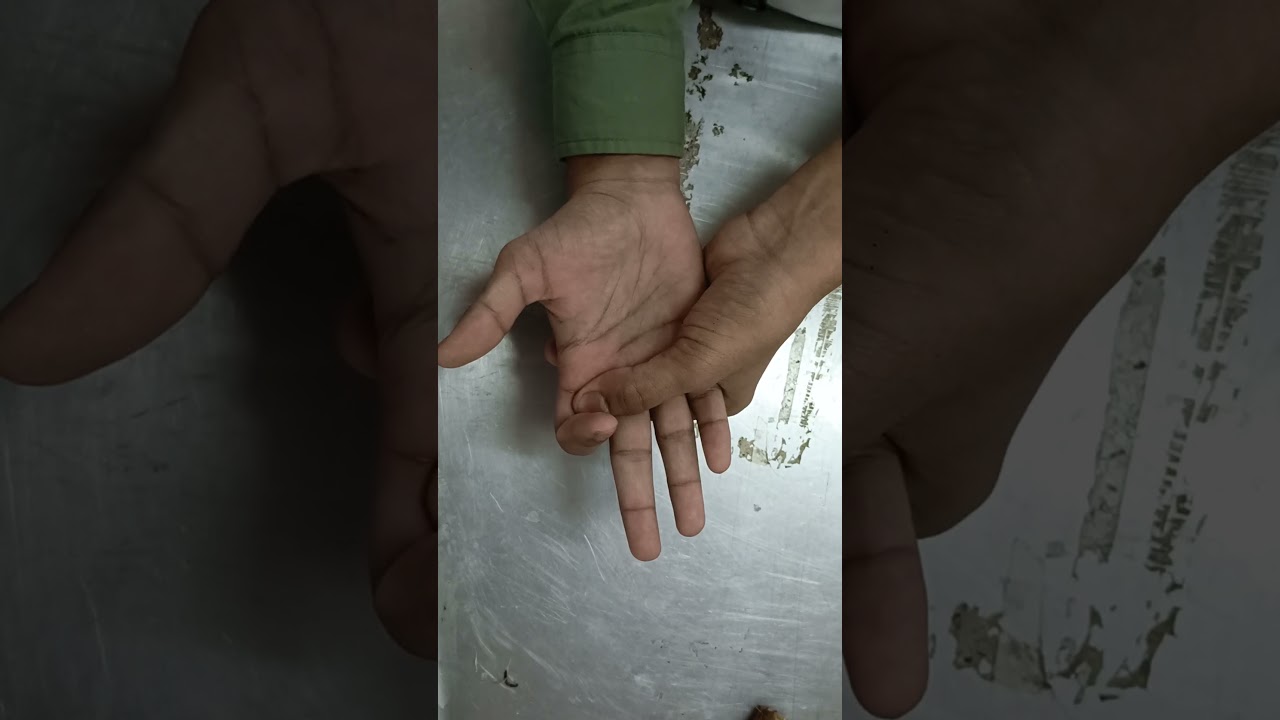 interphalangeal joints