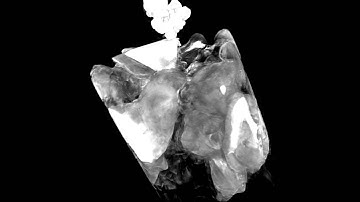 Zone-doubled Fresnel zone plates for high-resolution hard X-ray full-field transmission - 1