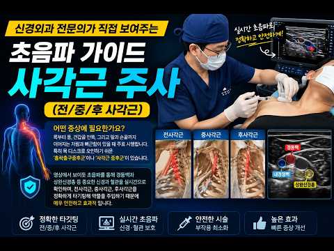 신경외과 전문의가 직접 보여주는 초음파 가이드 사각근 주사 (전/중/후 사각근)