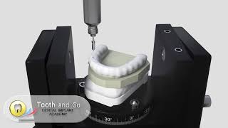 Straumann Guided Surgery