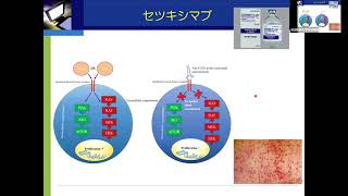 耳鼻咽喉科専門講義　頭頸部癌に対する化学療法