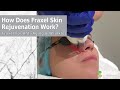 How does fraxel skin rejuvenation work