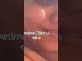 👉 हे जेल क्रीम कोणासाठी आहे? 😳#ytshorts #youtubeshorts #viral #trending #skincare