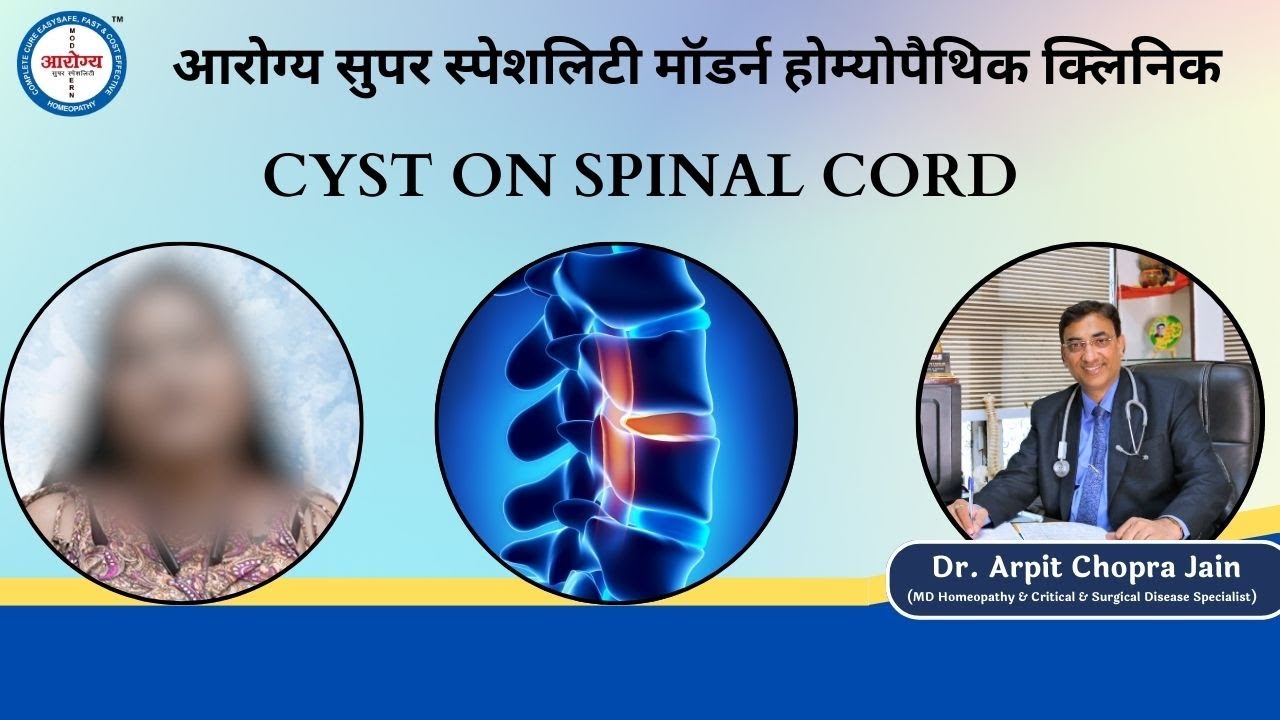 Cyst On spinal Cord Patient treatment at Aarogya Super Speciality Modern Homeopathy YouTube