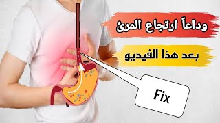 اعراض ارتجاع المرئ وعلاجه نهائيا بخطوات بسيطة جدا |الحموضه اسبابها وعلاجها