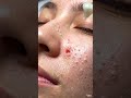 😲 Perfect Oil Plug Removal Satisfying ASMR