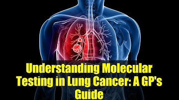 Understanding Molecular Testing in Lung Cancer: A GP