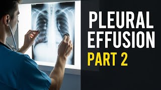 Pleural Effusion: Specific Considerations | Diagnosis & Management | Part 2 | Dr. Rais Khan