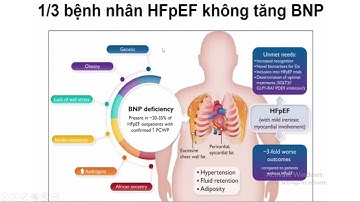 Suy tim phân suất tống má bảo tồn (Lâm sàng/Cận lâm sàng)