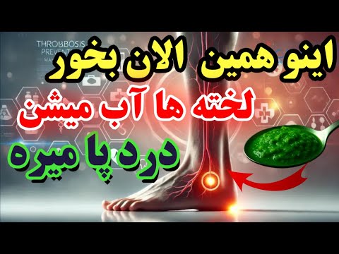 هشدار اگه این ۵ علامتو در پاهات داشتی فورا این غذارو بخور لخته ها آب میشن در پا میره