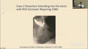 Phát hiện và xử trí biến chứng sau can thiệp Động mạch vành | CẤP CỨU TIM MẠCH (buổi 7)