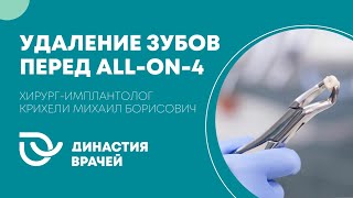 Удаление зубов во сне для ALL-ON-4 