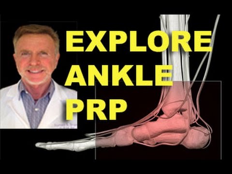 Can your achilles tendon be repaired with out surgery? Video on options.