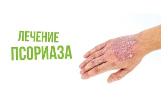 Лечение псориаза по Неумывакину|Крымский центр оздоровления Неумывакина