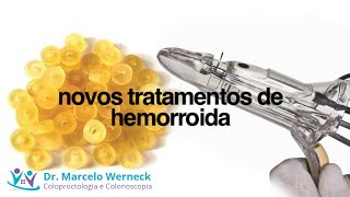 Novos tratamentos de hemorroida - LIVE! Dr. Marcelo Werneck e Dra. Thais Takahashi