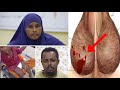 Xaniiyaha Ayay Ka Gaarici Jirtay Eedadiis Aabihiis Qabo 