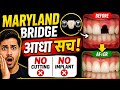 “आधा सच”No Implant ❌ No Bridge ❌ Phir Bhi Fixed दांत? 😱 ये Secret Treatment कैसे काम करता है!