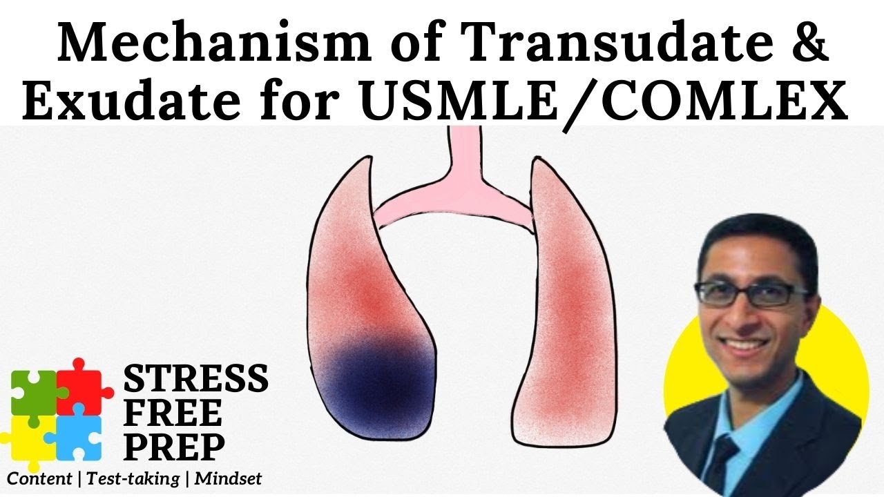 Stress Free Prep - Mechanisms of Transudative vs Exudative effusion