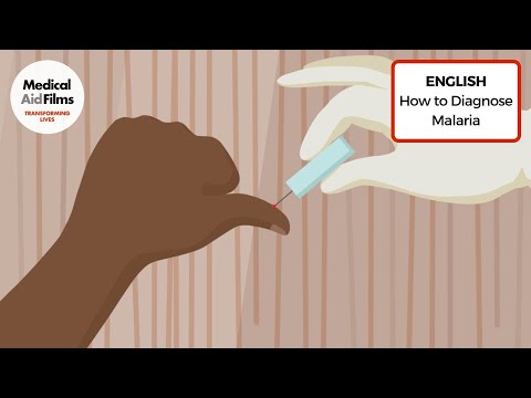 How to Diagnose Malaria