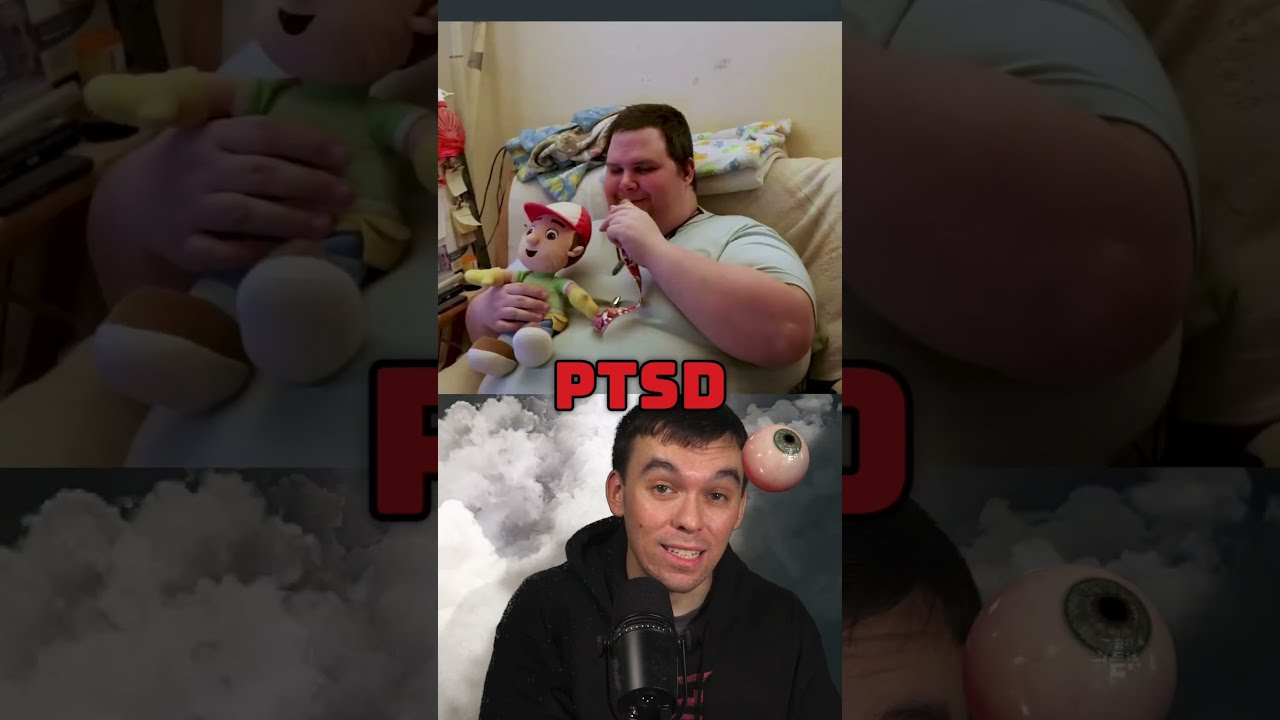 This 42 Year Old Man Identifies As A BABY But The Way He Lives Shocked World 