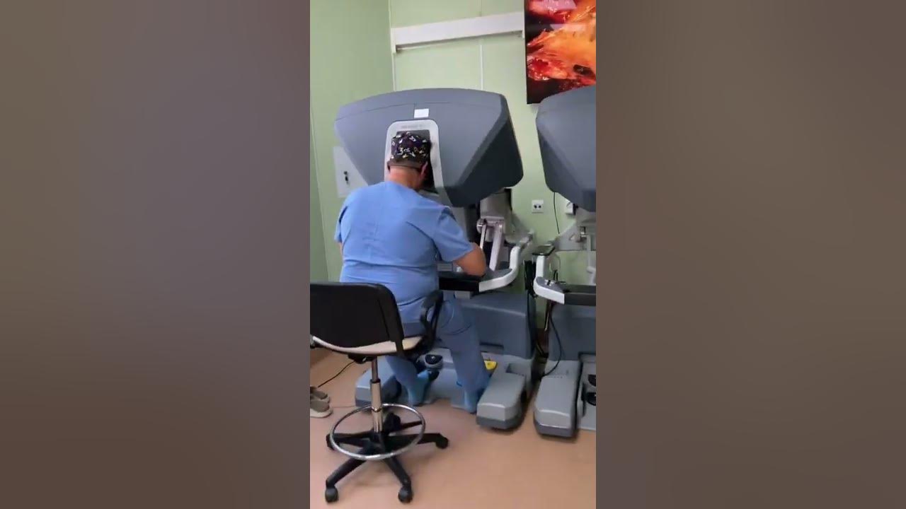 Удаление простаты роботом да винчи. HIFU терапия предстательной железы. Операция на простате лазером видео. Роботическая простатэктомия видео. Роботизированная простатэктомия ютуб.