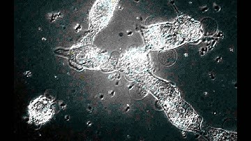 Oncosis in Cardiomyocytes