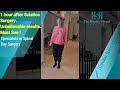 1 hour after Sciatica Surgery. Unbelievable results. Must See !