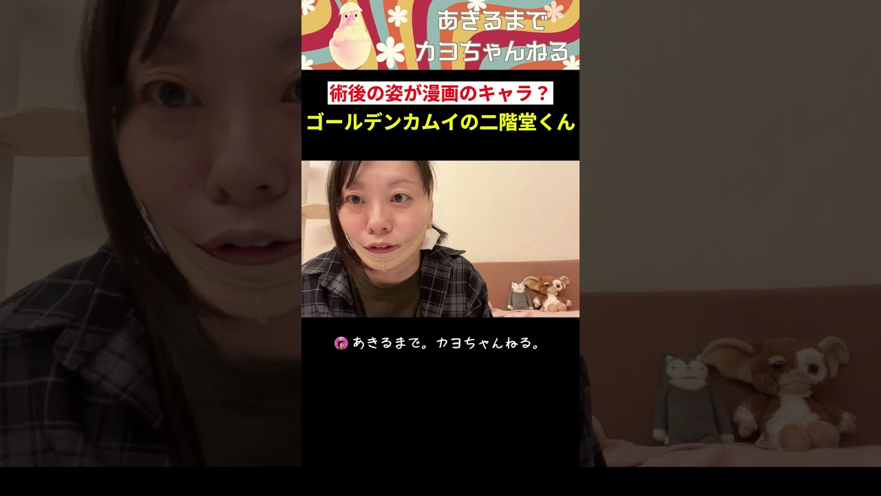 【整形後】これゴールデンカムイの!【顔脂肪吸引】 #アラフォー #ゴールデンカムイ #整形#ダウンタイム