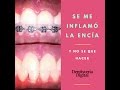 BRACKETS - Se me inflamó la encía y no se qué hacer!