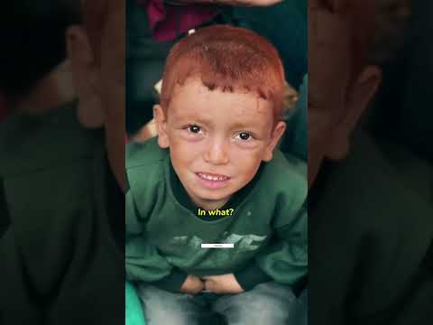 Jalal A Displaced Child From Jabalia Endures The Tragedy Of Starvation