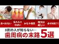 一度なったら戻れない!?歯周病が進行した後に起こること5選