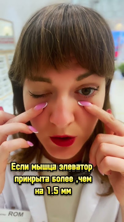 Птоз -прикрытие веком глаза и зрачка 🆘 - YouTube