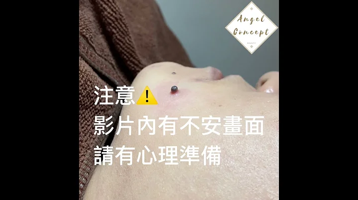 ANGEL CONCEPT 皇牌针清 - 天天要闻
