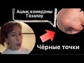 АШЫҚ КОМЕДОНЫ (ЧЁРНЫЕ ТОЧКИ)ҚАРА НҮКТЕЛЕРДІ  ҮЙ ЖАҒДАЙНДА ТАЗАЛАУ