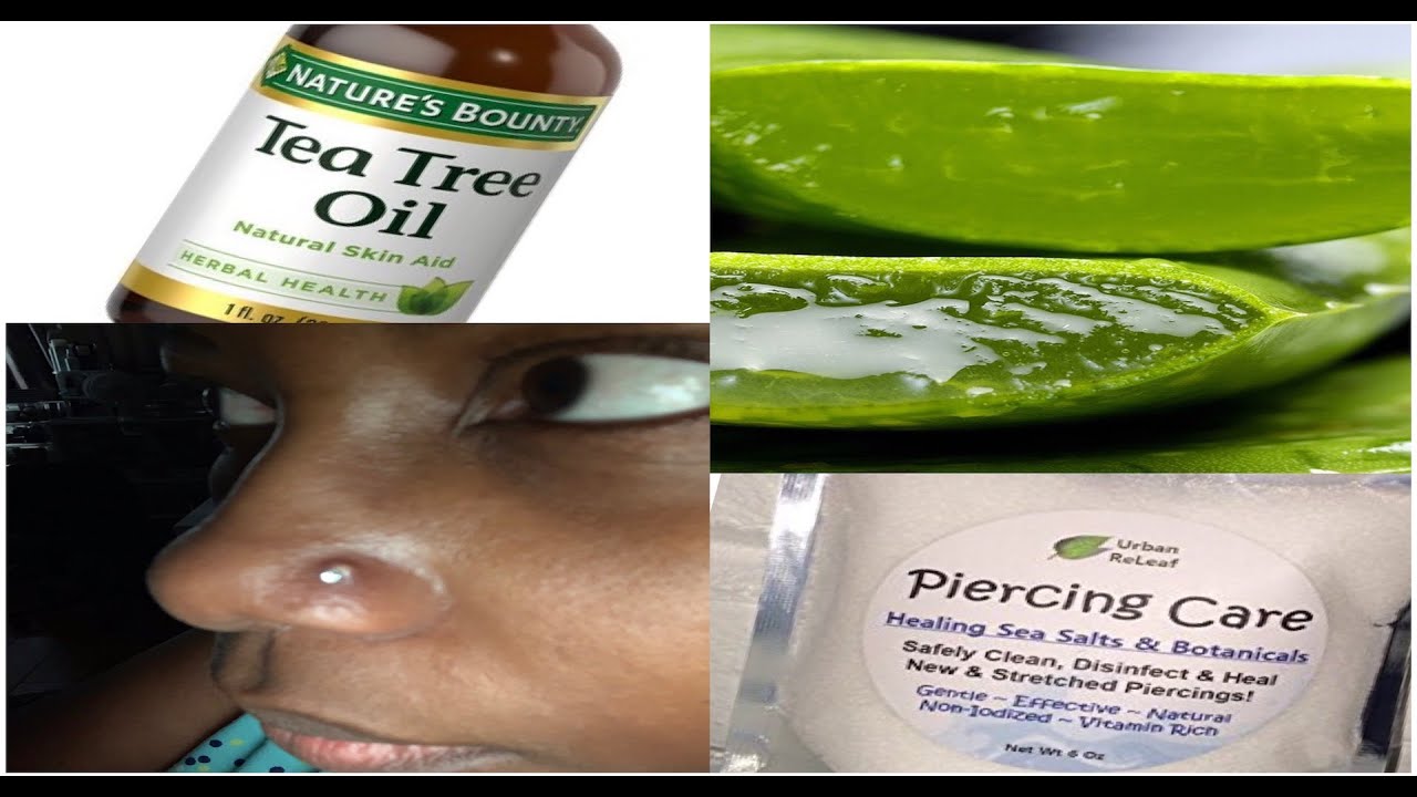 NO KELOIDS!!!! HEALING A NOSE RING BUMP WITH ALOE VERA!!!! YouTube