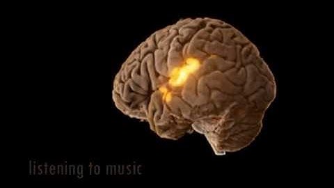 about ALEX: Meta-realistic Medical Moving Images of the Brain