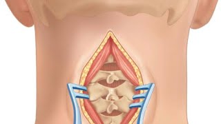 Neck Diseases part 1, Surgery lectures, Development disorders of neck