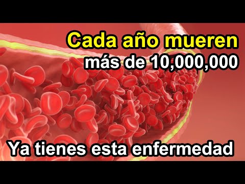 Tu ya estas sufriendo esta enfermedad desde hace tiempo....
