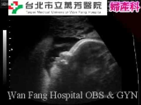 寶寶8個月側臉