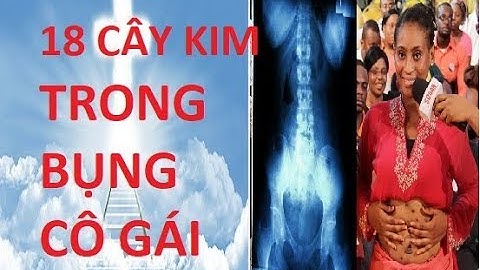 BÁC SỈ TÌM THẤY TRÊN 18 CÂY KIM TRONG BỤNG CÔ GÁI BỊ BÙA CHÚ THƯ ẾM