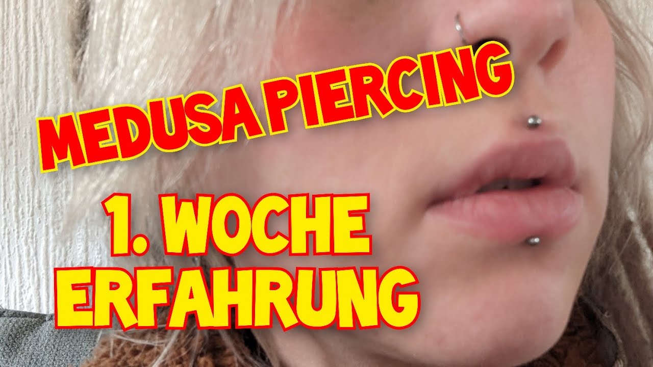 Medusa Piercing Erfahrung, Verheilung Woche 1 YouTube
