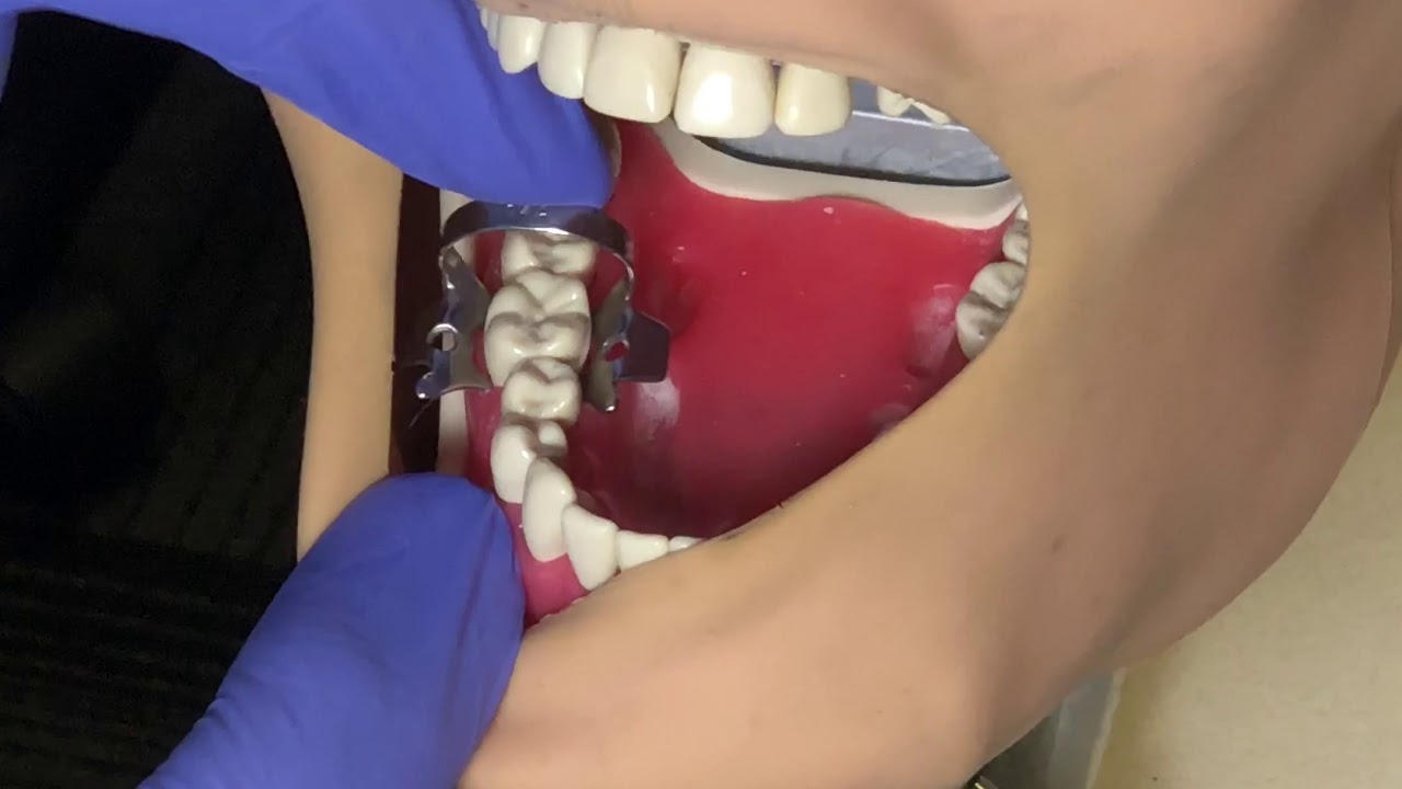 ADC Practical Exam Guidance: Rubber Dam Task by Ahmad Abdelhameed - PART 1