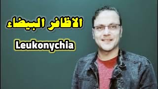 الاظافر البيضاء اوبياض الاظافر اسباب ظهور البقع أو اللون الابيض في الاظافر أو  leukonychia