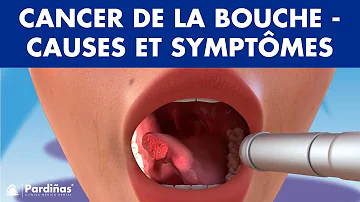 Est-ce qu'un cancer de la bouche fait mal ?