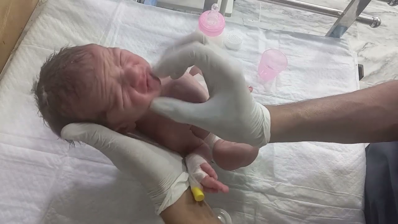 "A Miracle in the NICU: Baby's First Feeding After RDS & ENNS Recovery"viralvideo