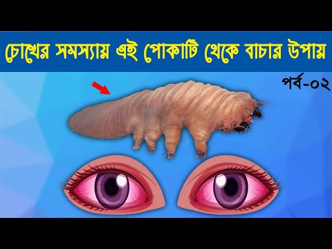 আপনার চোখের সমস্যায় ডেমোডেক্স মাইট পোকাটি থেকে বাচার উপায়। পর্ব 2