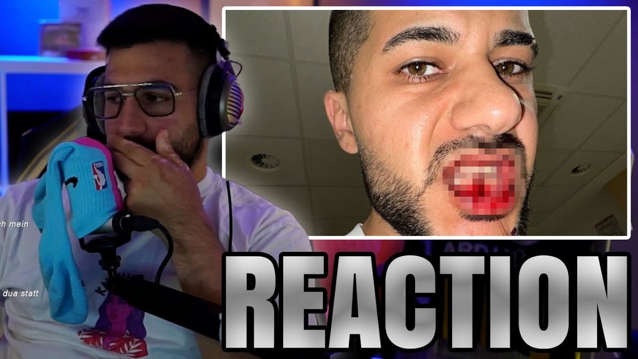 MERT REAGIERT AUF HAMEDLOCO KIEFER GEBROCHEN..