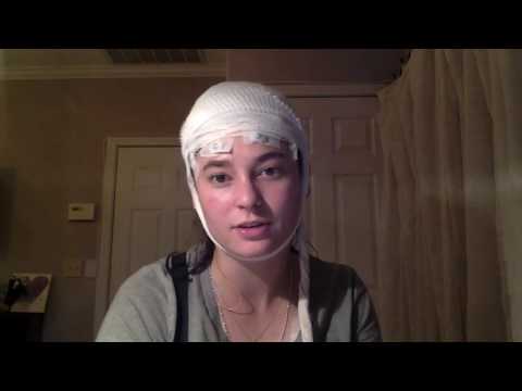 Video: Co je ambulantní EEG?